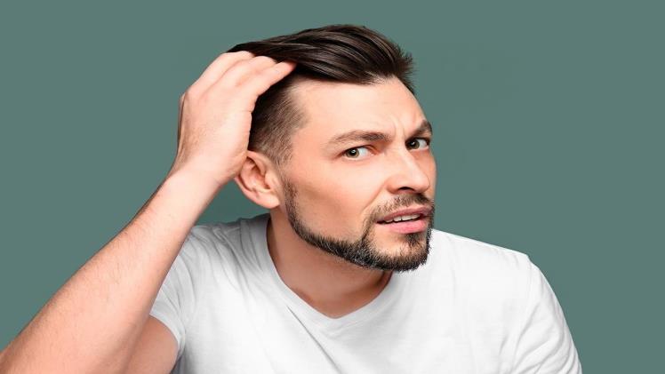 How to Stop Receding Hairline in Men – A Comprehensive Guide